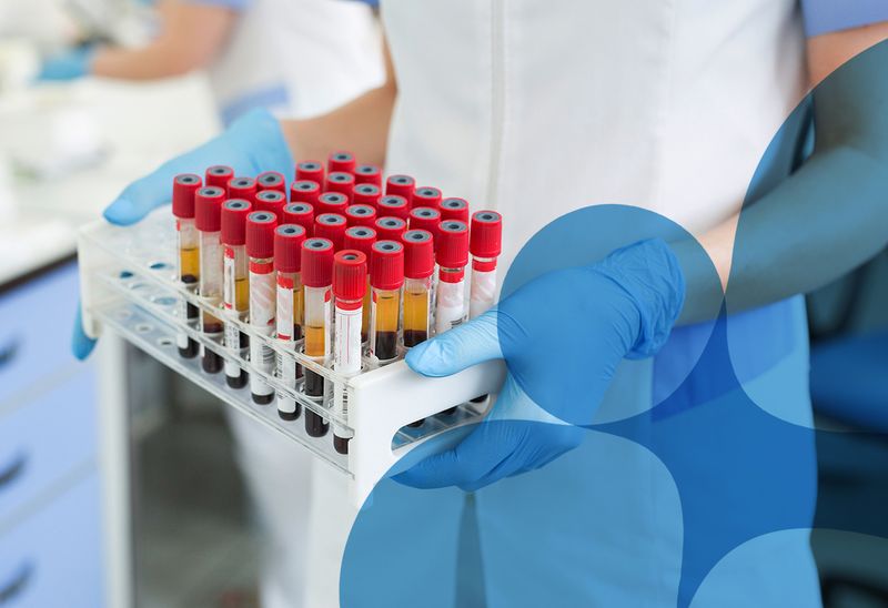 Technopath Clinical Diagnostics Launches the First Not-For-Profit COVID-19 Antibody Testing Initiative to Support Companies in Ireland